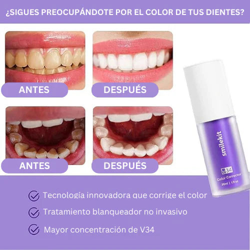 Blanqueador Dental V34™ - TRENDFINDER® (2024) + Cepillo Dental - Envio Gratis Hoy